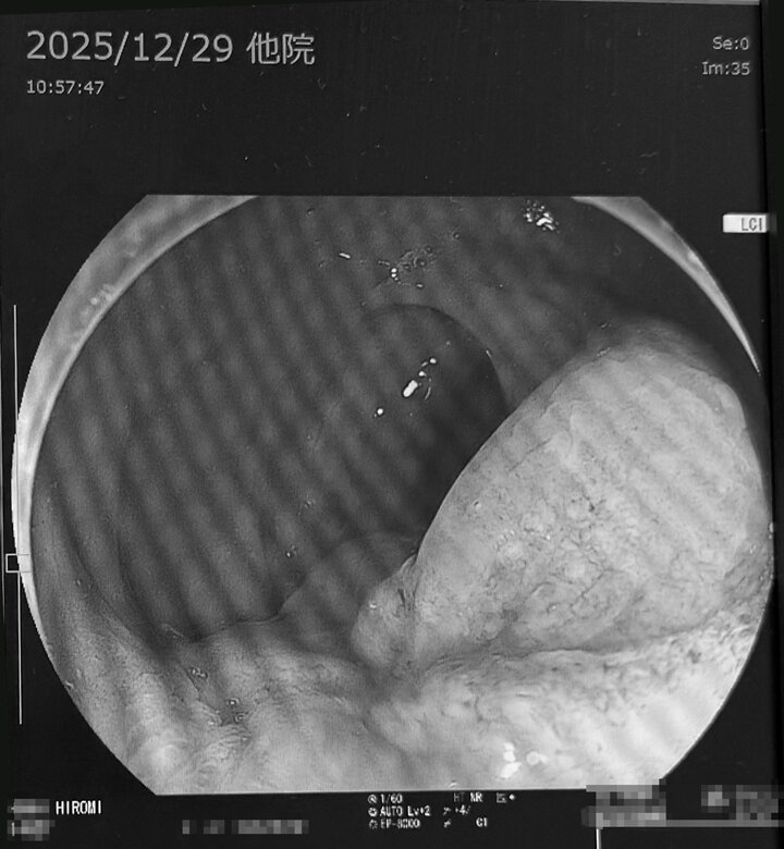 hiromisan_hospitalphoto2_720_WB.jpg